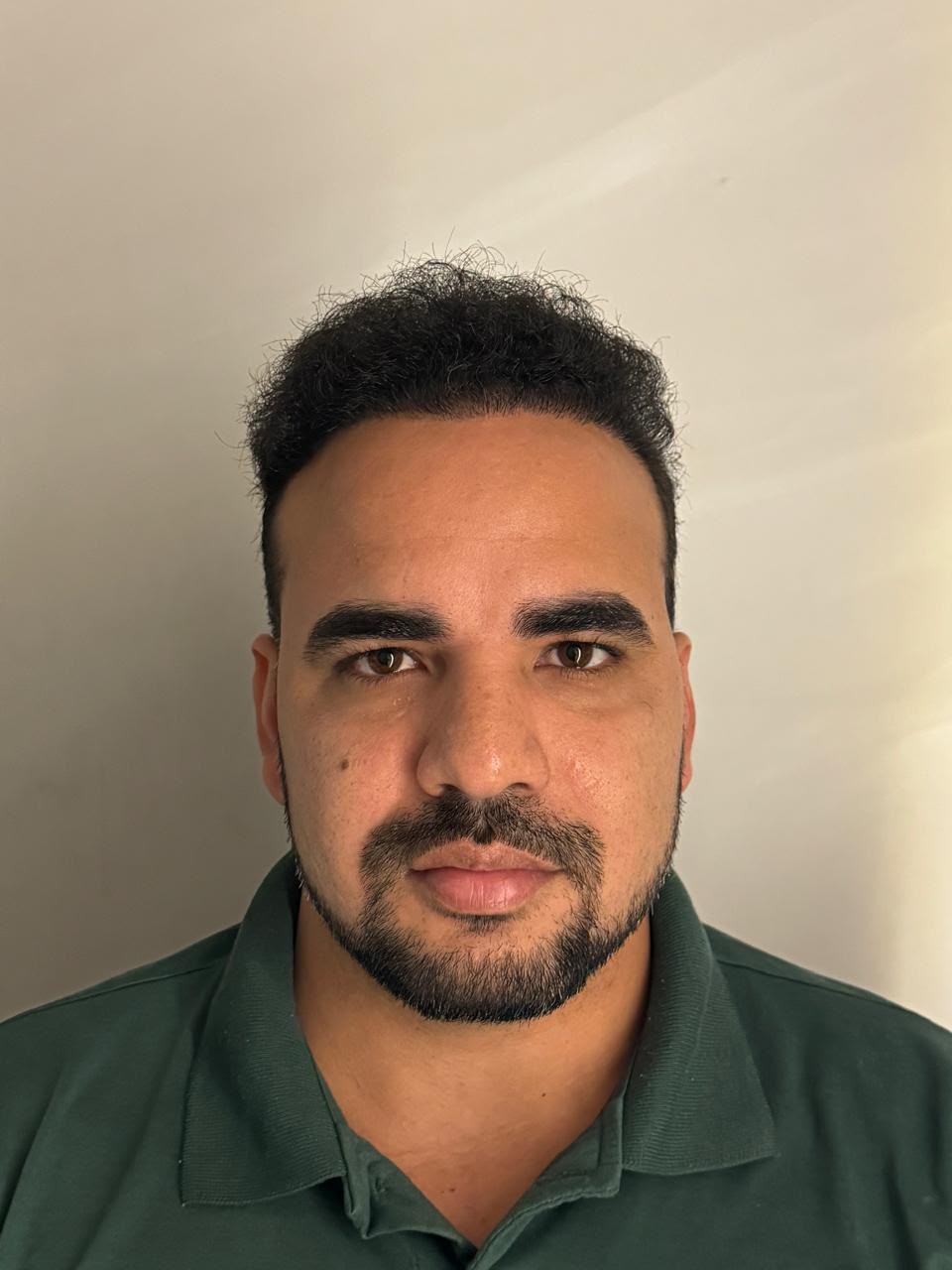 Caso 02, depois: vista frontal após o transplante